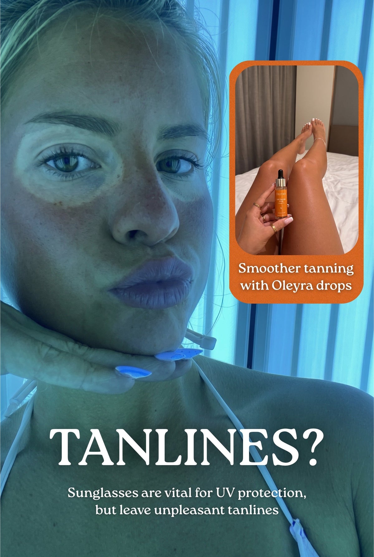 Uneven tan lines on skin, the problem an even mixed-in tan avoids