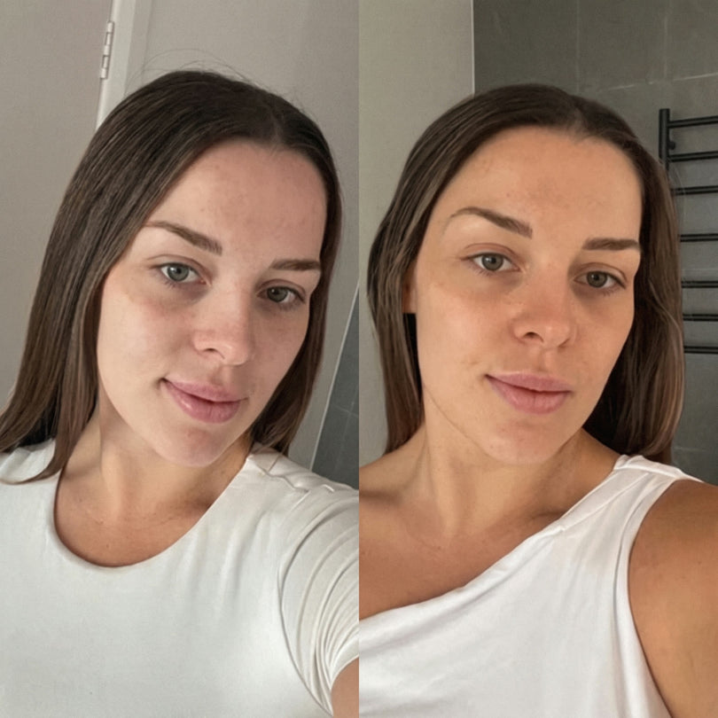 The same person before and after using the drops