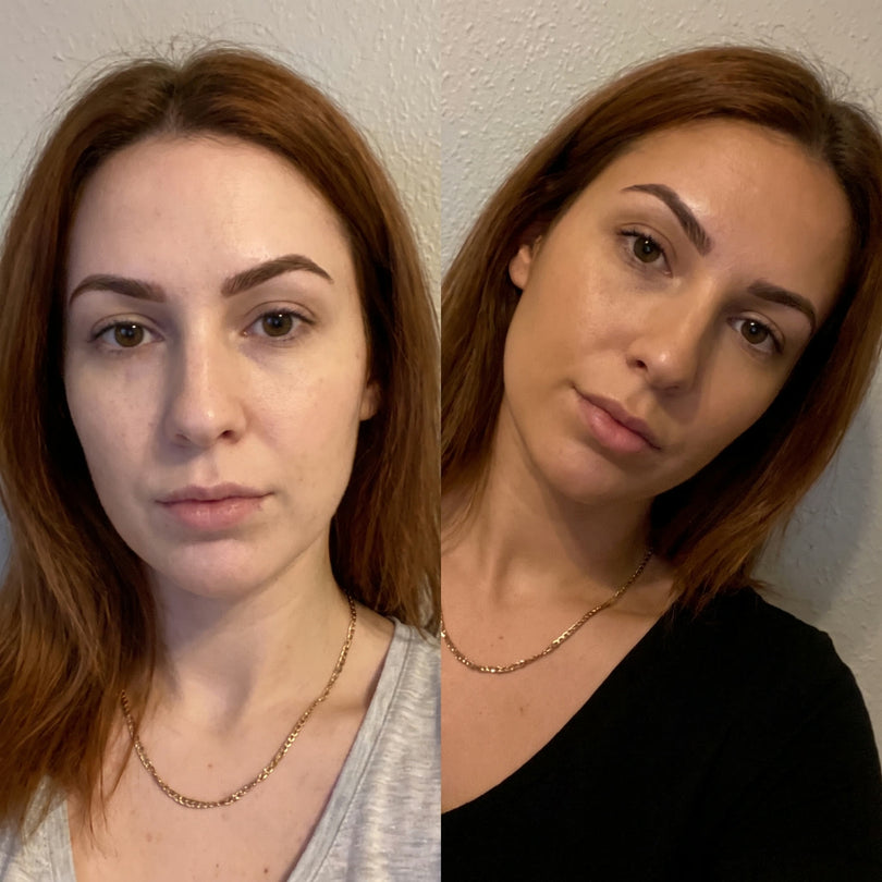 The same person before and after using the drops