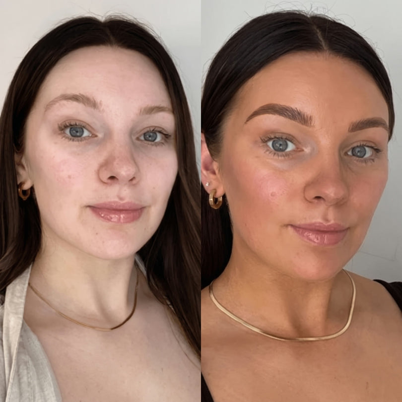 The same person before and after using the drops